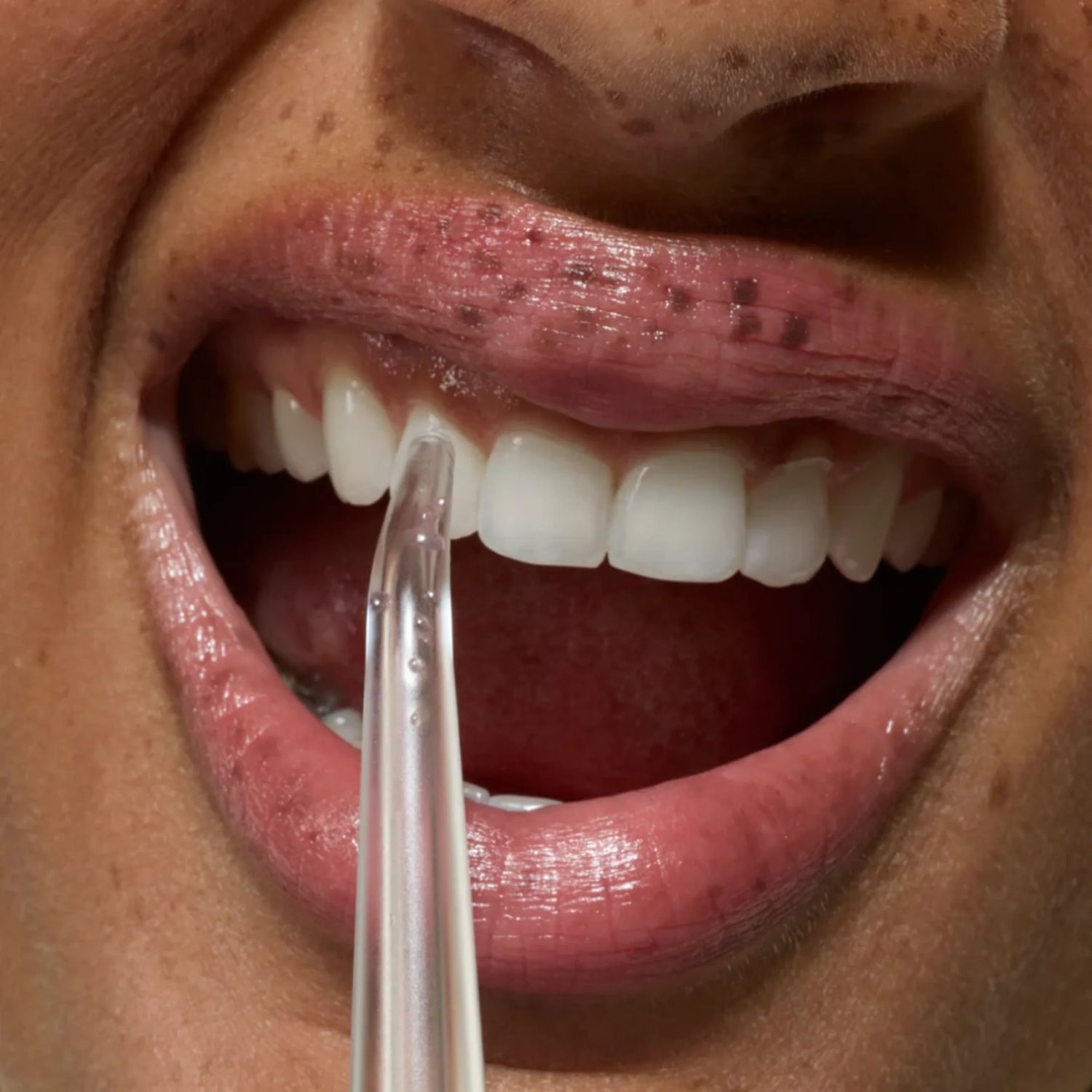 Medzizubné čistenie